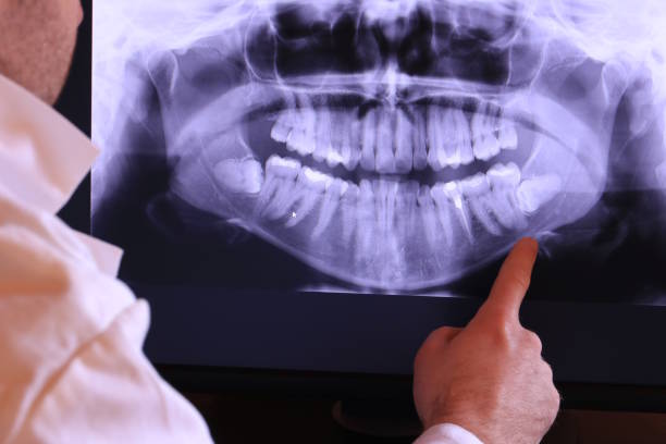 Best Emergency Dental Care for Trauma or Injury in Grand Mound, WA